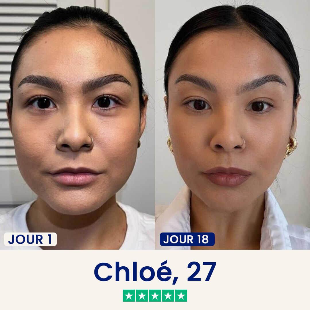 Minceor Lift : Réduit votre double menton sans effort