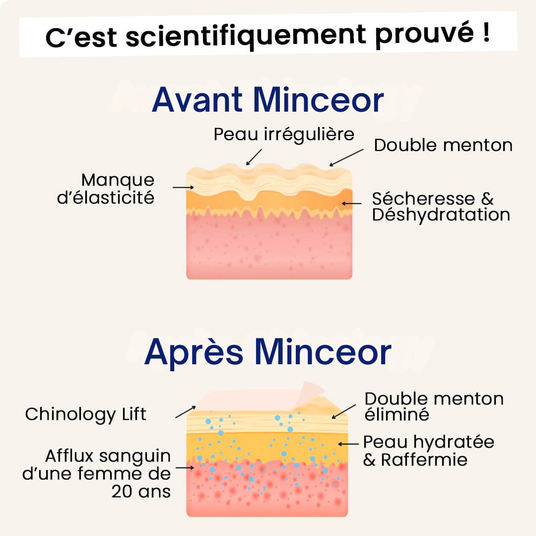 Minceor Lift : Réduit votre double menton sans effort