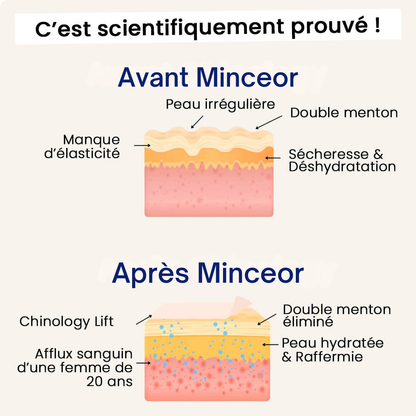 Minceor Lift : Réduit votre double menton sans effort